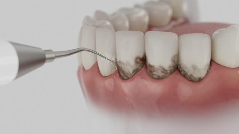 Reliable Dental contractor in Cohoes, NY by Smile Center Dentistry
